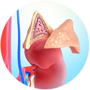 Cushing’s syndrome